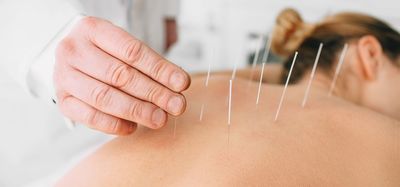 Link to: https://sparcchiropractic.clinicsites.co/services/acupuncture